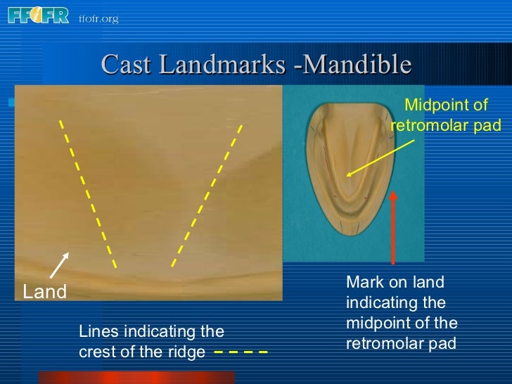 8.boxing impressions and making casts