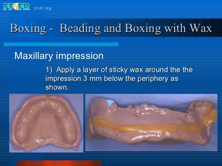 8.boxing impressions and making casts
