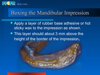 Boxing the Mandibular Impression
 Apply  a layer of rubber base adhesive or hot
  sticky wax to the impression as shown.
 This layer should about 3 mm above the
  height of the border of the impression.
 