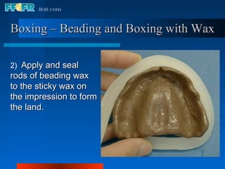 Boxing – Beading and Boxing with Wax

2) Apply and seal
rods of beading wax
to the sticky wax on
the impression to form
the land.
 