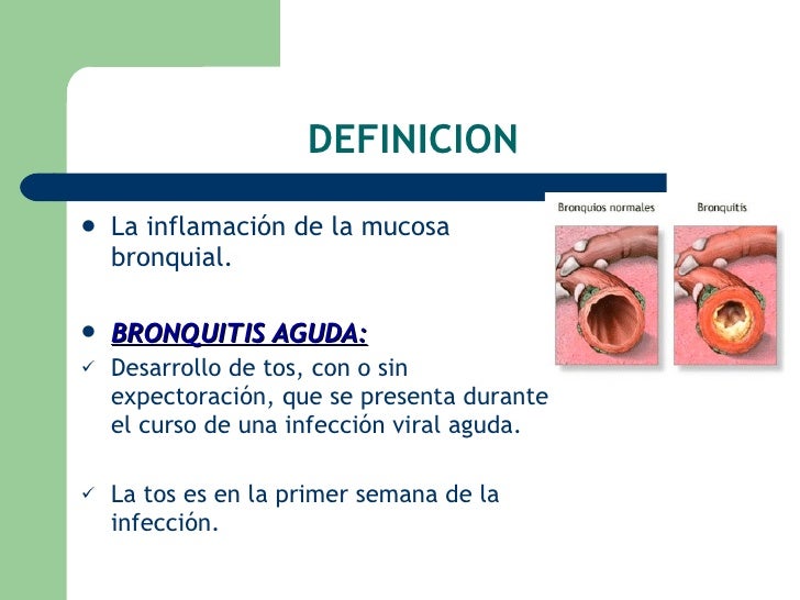 concepto y sintomas de bronquitis