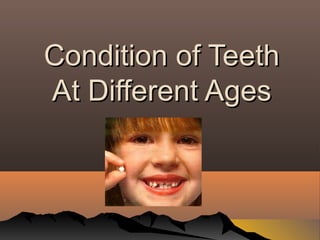 Condition of Teeth
At Different Ages

 