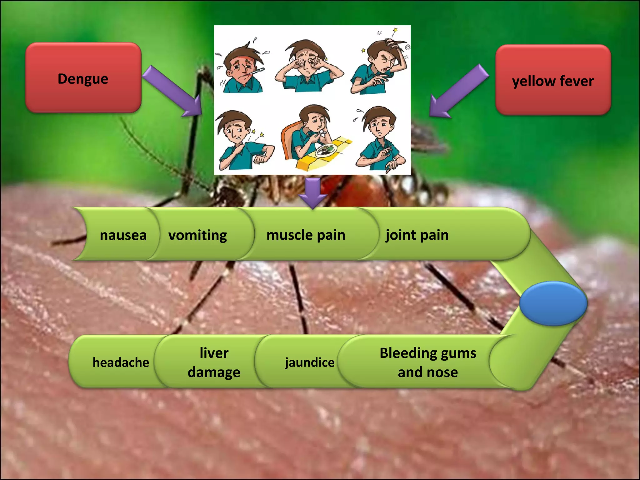 Dengue                                                  yellow fever




     nausea    vomiting   muscle pain   joint pain




                  liver                 Bleeding gums
    headache                jaundice
                 damage                    and nose
 