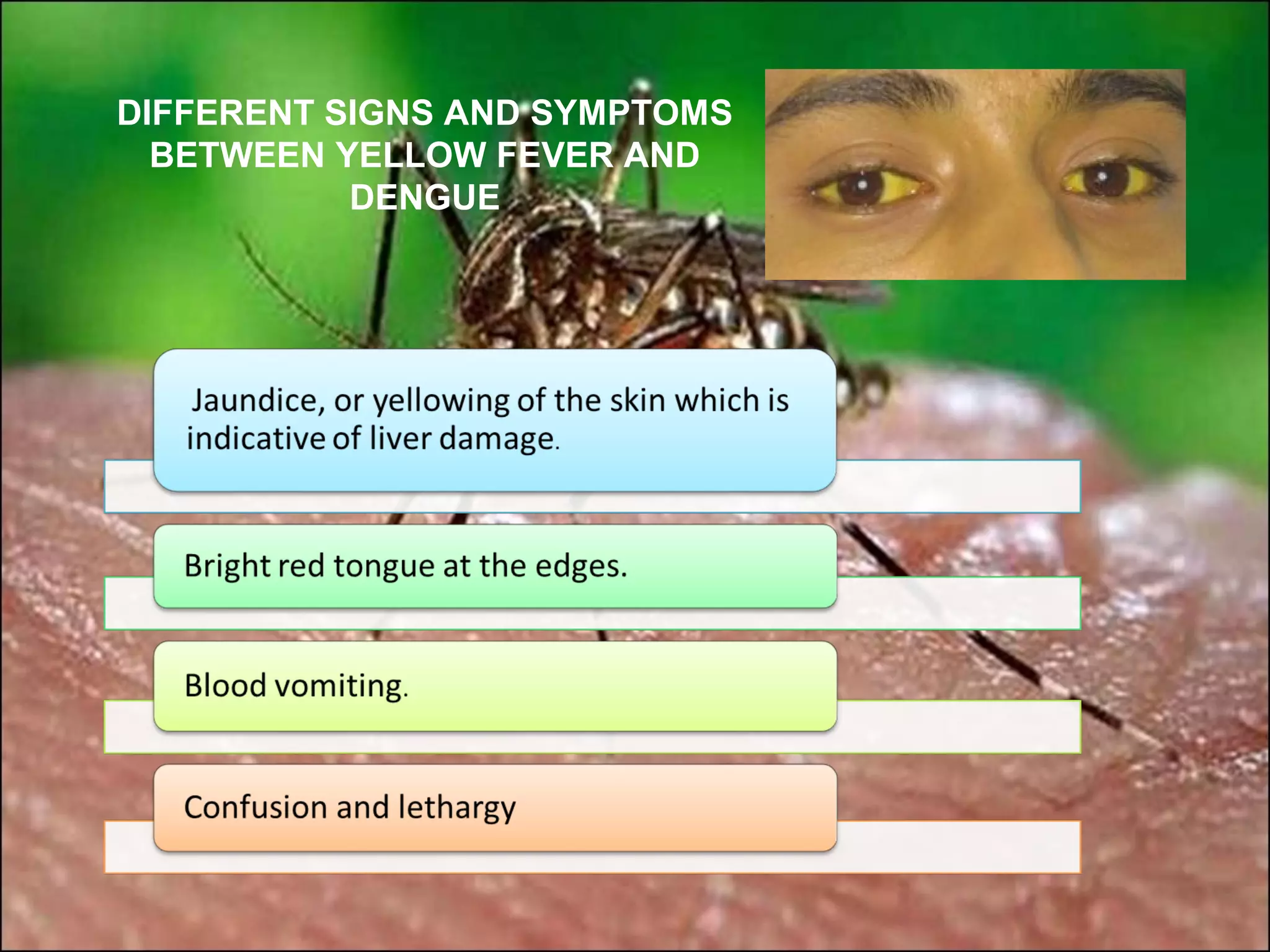 DIFFERENT SIGNS AND SYMPTOMS
  BETWEEN YELLOW FEVER AND
           DENGUE
 