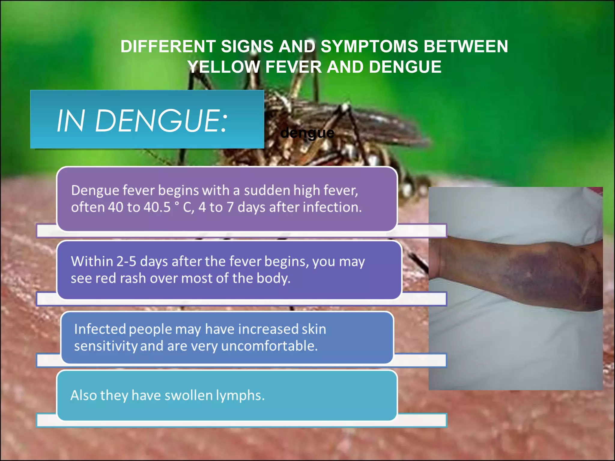 DIFFERENT SIGNS AND SYMPTOMS BETWEEN
         YELLOW FEVER AND DENGUE


IN DENGUE:
 IN DENGUE:      dengue
 
