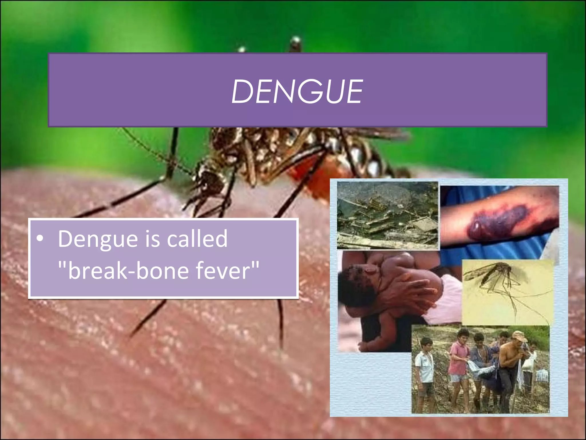 DENGUE



• Dengue is called
  "break-bone fever"
 