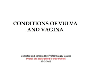 8 Lesions of vulva and vagina 19-3-2018