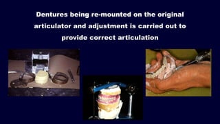 Dentures being re-mounted on the original
articulator and adjustment is carried out to
provide correct articulation
 