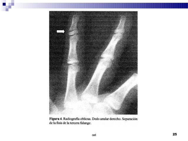 La medicina los aparatos para el tratamiento de la osteocondrosis
