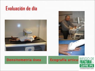 Densitometria ósea Ecografía articular 