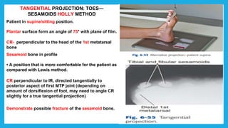 TANGENTIAL PROJECTION: TOES—
SESAMOIDS HOLLY METHOD
Patient in supine/sitting position.
Plantar surface form an angle of 75° with plane of film.
CR- perpendicular to the head of the 1st metatarsal
bone
Sesamoid bone in profile
• A position that is more comfortable for the patient as
compared with Lewis method.
CR perpendicular to IR, directed tangentially to
posterior aspect of first MTP joint (depending on
amount of dorsiflexion of foot, may need to angle CR
slightly for a true tangential projection)
Demonstrate possible fracture of the sesamoid bone.
 