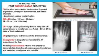 AP PROJECTION:
FOOT DORSOPLANTAR PROJECTION
CI - Location and extent of fractures and fragment
alignments, joint space abnormalities, soft tissue
effusions
• Location of opaque foreign bodies
SID—40 inches (102 cm) • IR size—
24 × 30 cm (10 × 12 inches),
CR - Angle CR 10° posteriorly (toward heel) with CR
perpendicular to metatarsals (see Note). • Direct CR to
base of third metatarsal.
CR perpendicular to the base of the 3rd metatarsal.
Dorsoplantar is the preferred name for the AP
projection of the foot.
Anatomy Demonstrated: • Entire foot should be
demonstrated, including all phalanges and metatarsals
and navicular, cuneiforms, and cuboids.
 