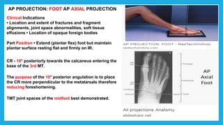 AP PROJECTION: FOOT AP AXIAL PROJECTION
Clinical Indications
• Location and extent of fractures and fragment
alignments, joint space abnormalities, soft tissue
effusions • Location of opaque foreign bodies
Part Position • Extend (plantar flex) foot but maintain
plantar surface resting flat and firmly on IR.
CR - 10° posteriorly towards the calcaneus entering the
base of the 3rd MT.
The purpose of the 10° posterior angulation is to place
the CR more perpendicular to the metatarsals therefore
reducing foreshortening.
TMT joint spaces of the midfoot best demonstrated.
 