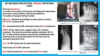 AP OBLIQUE PROJECTION - MEDIAL ROTATION:
FOOT
Clinical Indications
• Location and extent of fractures and fragment alignments,
joint space abnormalities, soft tissue effusions
• Location of opaque foreign bodies
Part pos., Rotate foot medially to place plantar surface
30° to 40° to plane of IR
CR - perpendicular to IR, directed to base of 3rd metatarsal
NOTE: Some references suggest only a 30° oblique
routinely. This text recommends greater obliquity, 40° to
45°, to demonstrate tarsals and proximal metatarsals best
relatively free of superimposition for the foot with an
average transverse arch.
3rd - 5th MT bases free of superimposition
Tuberosity of 5th MT well seen
Best demonstrate the cuboid bone and Sinus tarsi
 