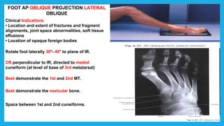 FOOT AP OBLIQUE PROJECTION LATERAL
OBLIQUE
Clinical Indications
• Location and extent of fractures and fragment
alignments, joint space abnormalities, soft tissue
effusions
• Location of opaque foreign bodies
Rotate foot laterally 30°- 45° to plane of IR.
CR perpendicular to IR, directed to medial
cuneiform (at level of base of 3rd metatarsal)
Best demonstrate the 1st and 2nd MT.
Best demonstrate the navicular bone.
Space between 1st and 2nd cuneiforms.
 