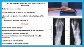FOOT PA PLANTODORSAL OBLIQUE GRASHEY
METHOD
Patient in prone position
CR perpendicular to base of 3rd metatarsal.
Alternative projection for medial or lateral oblique of the
foot.
1. Rotate foot and heel medially 30°
Navicular
Same as AP lateral oblique
demonstrate interspaces between 1st & 2nd metatarsal
2. Rotate foot and heel laterally 20°
Demonstrate interspaces between 2nd, 3rd, 4th & 5th
metatarsal
Tuberosity of 5th metatarsal
Cuboid same as AP medial oblique
 
