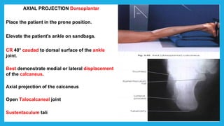 AXIAL PROJECTION Dorsoplantar
Place the patient in the prone position.
Elevate the patient's ankle on sandbags.
CR 40° caudad to dorsal surface of the ankle
joint.
Best demonstrate medial or lateral displacement
of the calcaneus.
Axial projection of the calcaneus
Open Talocalcaneal joint
Sustentaculum tali
 