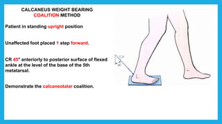 CALCANEUS WEIGHT BEARING
COALITION METHOD
Patient in standing upright position
Unaffected foot placed 1 step forward.
CR 45° anteriorly to posterior surface of flexed
ankle at the level of the base of the 5th
metatarsal.
Demonstrate the calcaneotalar coalition.
 
