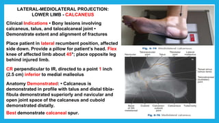 LATERAL-MEDIOLATERAL PROJECTION:
LOWER LIMB - CALCANEUS
Clinical Indications • Bony lesions involving
calcaneus, talus, and talocalcaneal joint •
Demonstrate extent and alignment of fractures
Place patient in lateral recumbent position, affected
side down. Provide a pillow for patient’s head. Flex
knee of affected limb about 45°; place opposite leg
behind injured limb.
CR perpendicular to IR, directed to a point 1 inch
(2.5 cm) inferior to medial malleolus
Anatomy Demonstrated: • Calcaneus is
demonstrated in profile with talus and distal tibia-
fibula demonstrated superiorly and navicular and
open joint space of the calcaneus and cuboid
demonstrated distally.
Best demonstrate calcaneal spur.
 