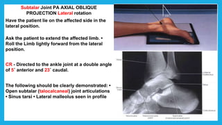 Subtalar Joint PA AXIAL OBLIQUE
PROJECTION Lateral rotation
Have the patient lie on the affected side in the
lateral position.
Ask the patient to extend the affected limb. •
Roll the Limb lightly forward from the lateral
position.
CR - Directed to the ankle joint at a double angIe
of 5˚ anterior and 23˚ caudal.
The following should be clearly demonstrated: •
Open subtalar (talocalcaneal) joint articulations
• Sinus tarsi • Lateral malleolus seen in profile
 