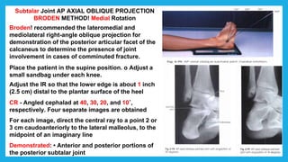 Subtalar Joint AP AXIAL OBLIQUE PROJECTION
BRODEN METHOD! Medial Rotation
Broden! recommended the lateromedial and
mediolateral right-angle oblique projection for
demonstration of the posterior articular facet of the
calcaneus to determine the presence of joint
involvement in cases of comminuted fracture.
Place the patient in the supine position. o Adjust a
small sandbag under each knee.
Adjust the IR so that the lower edge is about 1 inch
(2.5 cm) distal to the plantar surface of the heel
CR - Angled cephalad at 40, 30, 20, and 10˚,
respectively. Four separate images are obtained
For each image, direct the central ray to a point 2 or
3 cm caudoanteriorly to the lateral malleolus, to the
midpoint of an imaginary line
Demonstrated: • Anterior and posterior portions of
the posterior subtalar joint
 