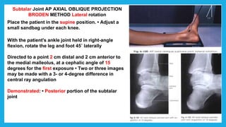 Subtalar Joint AP AXIAL OBLIQUE PROJECTION
BRODEN METHOD Lateral rotation
Place the patient in the supine position. • Adjust a
small sandbag under each knee.
With the patient's ankle joint held in right-angle
flexion, rotate the leg and foot 45˚ laterally
Directed to a point 2 cm distal and 2 cm anterior to
the medial malleolus, at a cephalic angle of 15
degrees for the first exposure • Two or three images
may be made with a 3- or 4-degree difference in
central ray angulation
Demonstrated: • Posterior portion of the subtalar
joint
 
