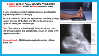 Subtalar Joint AP AXIAL OBLIQUE PROJECTION
ISHERWOOD METHOD Medial rotation ankle
a semi lateral recumbent position is more comfortable,
adjust the patient accordingly.
Ask the patient to rotate the leg and foot medially enough
to rest the side of the foot and affected ankle on an
optional 30-degree foam wedge
CR - Directed to a point I inch (2.5 cm) distal and I inch
(2.5 cm) anterior to the lateral malleolus at an angle of 10
degrees cephalad.
Demonstrated: • Middle (subtalar) articulation • Open
sinus tarsi
 