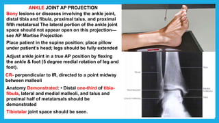 ANKLE JOINT AP PROJECTION
Bony lesions or diseases involving the ankle joint,
distal tibia and fibula, proximal talus, and proximal
fifth metatarsal The lateral portion of the ankle joint
space should not appear open on this projection—
see AP Mortise Projection
Place patient in the supine position; place pillow
under patient’s head; legs should be fully extended
Adjust ankle joint in a true AP position by flexing
the ankle & foot (5 degree medial rotation of leg and
foot).
CR- perpendicular to IR, directed to a point midway
between malleoli
Anatomy Demonstrated: • Distal one-third of tibia-
fibula, lateral and medial malleoli, and talus and
proximal half of metatarsals should be
demonstrated
Tibiotalar joint space should be seen.
 