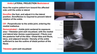 Ankle LATERAL PROJECTION Mediolateral
Have the supine patient turn toward the affected
side until the ankle is lateral
Dorsiflex the foot, and adjust it in the lateral
position. Dorsiflexion is required to prevent lateral
rotation of the ankle.
CR - Perpendicular to the ankle joint, entering the
medial malleolus
Demonstrated: • Ankle joint centered to exposure
area • Tibiotalar joint well visualized, with the medial
and lateral talar domes superimposed • Fibula over
the posterior half of the tibia • Distal tibia and fibula,
talus, and adjacent tarsals • Density of the ankle
sufficient to see the outline of distal portion of the
fibula
Tibiotalar joint well visualized
 