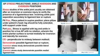 AP STRESS PROJECTIONS: ANKLE INVERSION AND
EVERSION POSITIONS
Stress studies of the ankle joint usually are obtained
after an inversion or eversion injury to verify the
presence of a ligamentous tear. involving ankle joint
separation secondary to ligament tear or rupture
PX Pos., Place patient in supine position; place pillow
under patient’s head; leg should be fully extended,
with support under knee.
Part pos., Stress is applied with leg and ankle in
position for a true AP with no rotation, wherein the
entire plantar surface is turned medially for inversion
and laterally for eversion.
CR - perpendicular to midway between malleoli.
Demonstrate possible ligament tear or rupture.
Inversion stress study demonstrate possible lateral
ligament tear.
Eversion stress study demonstrate possible medial
ligament tear.
 