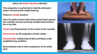 ANKLE AP WEIGHT-BEARING METHOD
This projection is performed to identify ankle joint
space narrowing with weight bearing.
Patient in upright position.
Have the patient stand with heels pushed back against
the cassette and toes pointing straight ahead toward
the x-ray tube
Central ray Perpendicular to the center of the cassette
Demonstrate an AP projection of both ankles.
Demonstrates relationship of tibia and fibula under
weightbearing condition.
Demonstrates side to side comparison of the ankle
joint.
 