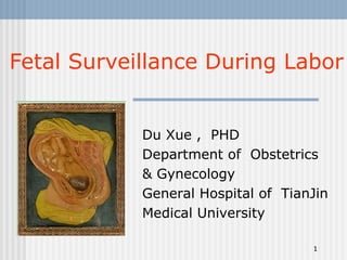 Fetal Surveillance During Labor Du Xue ,  PHD Department of  Obstetrics  & Gynecology  General Hospital of  TianJin Medical University 