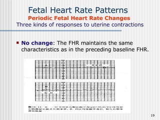 8.Fetal Surveillance During Labor | PPT