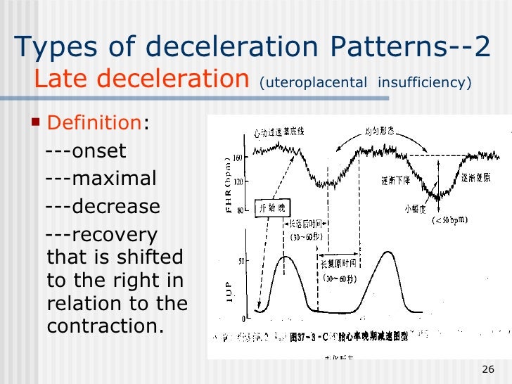 decelerate definition decelerate definition