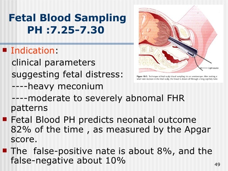 8.Fetal Surveillance During Labor