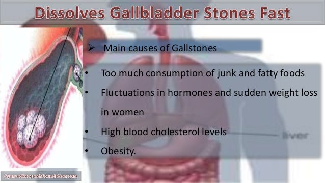 How To Treat Gallbladder Attacks Naturally How To Treat Gallbladder Attacks Naturally