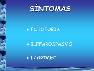 SÍNTOMAS

FOTOFOBIA


BLEFAROSPASMO

LAGRIMEO
 