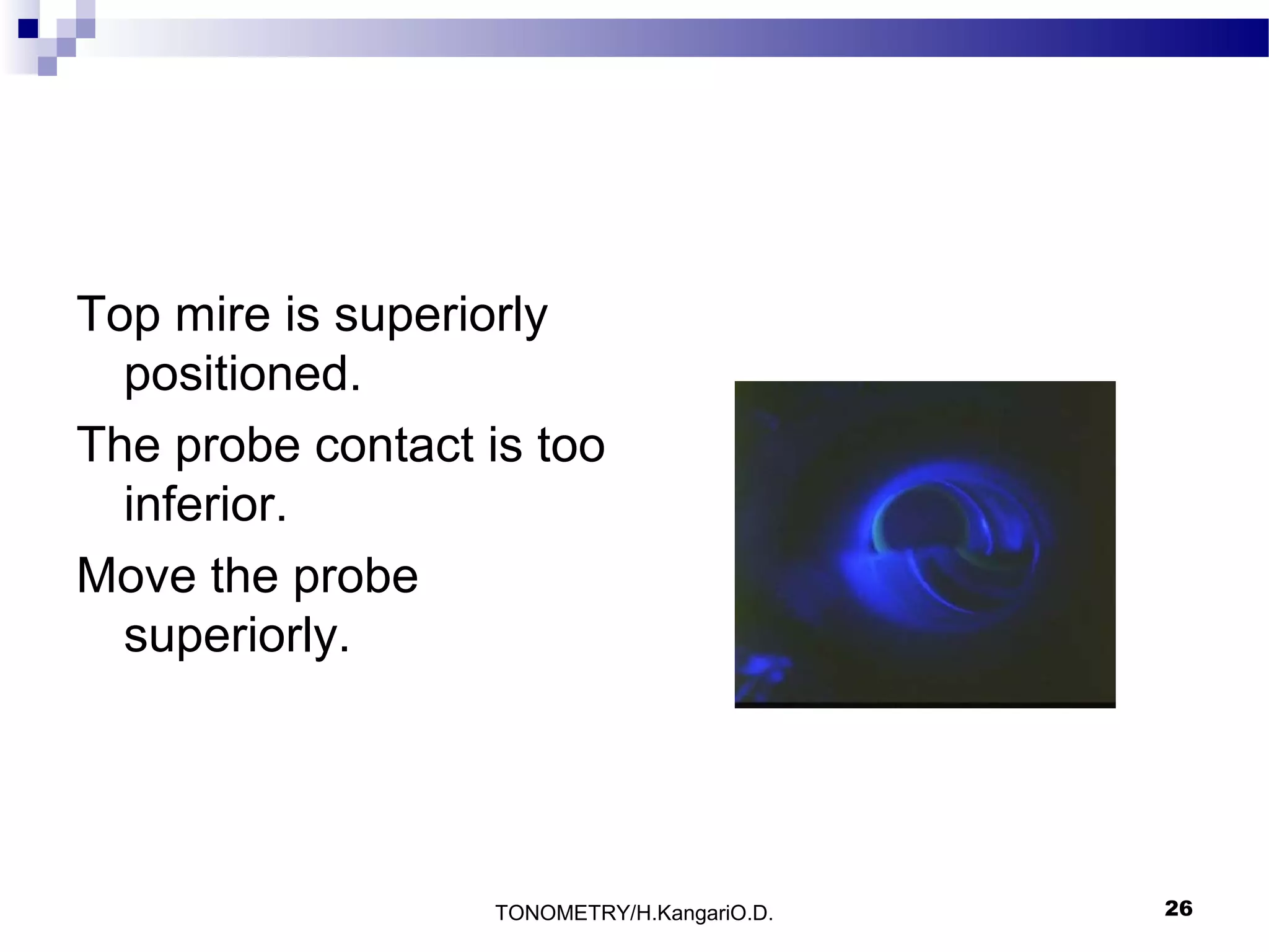 Top mire is superiorly
positioned.
The probe contact is too
inferior.
Move the probe
superiorly.

TONOMETRY/H.KangariO.D.

26

 