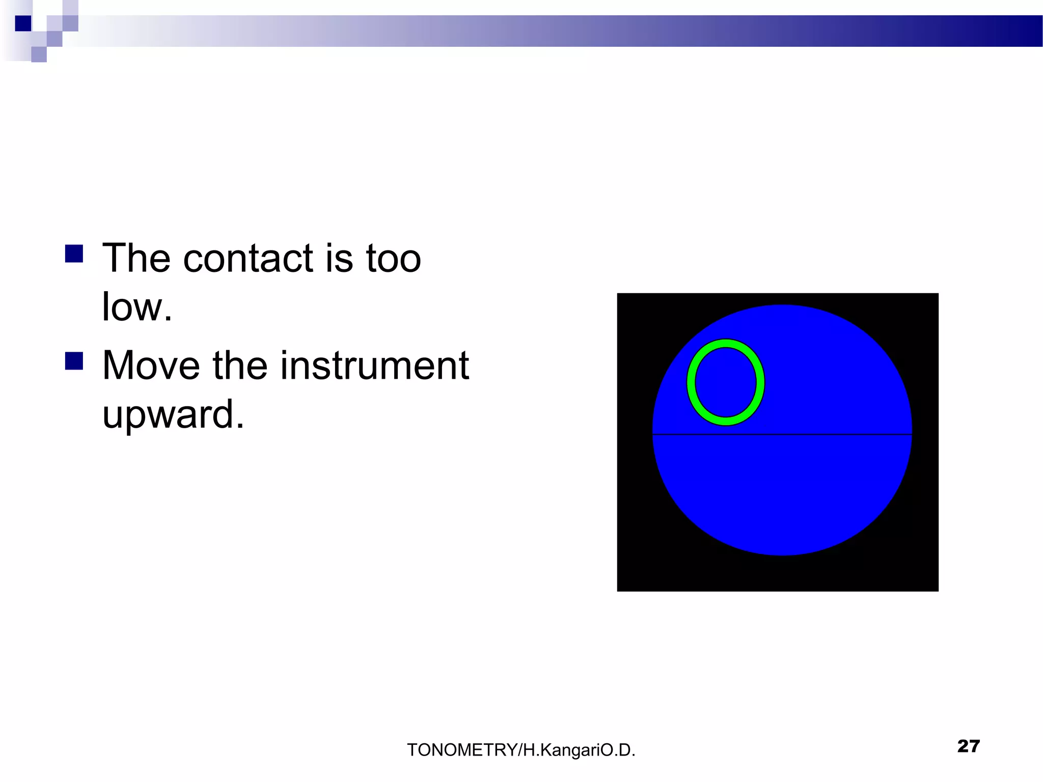 



The contact is too
low.
Move the instrument
upward.

TONOMETRY/H.KangariO.D.

27

 