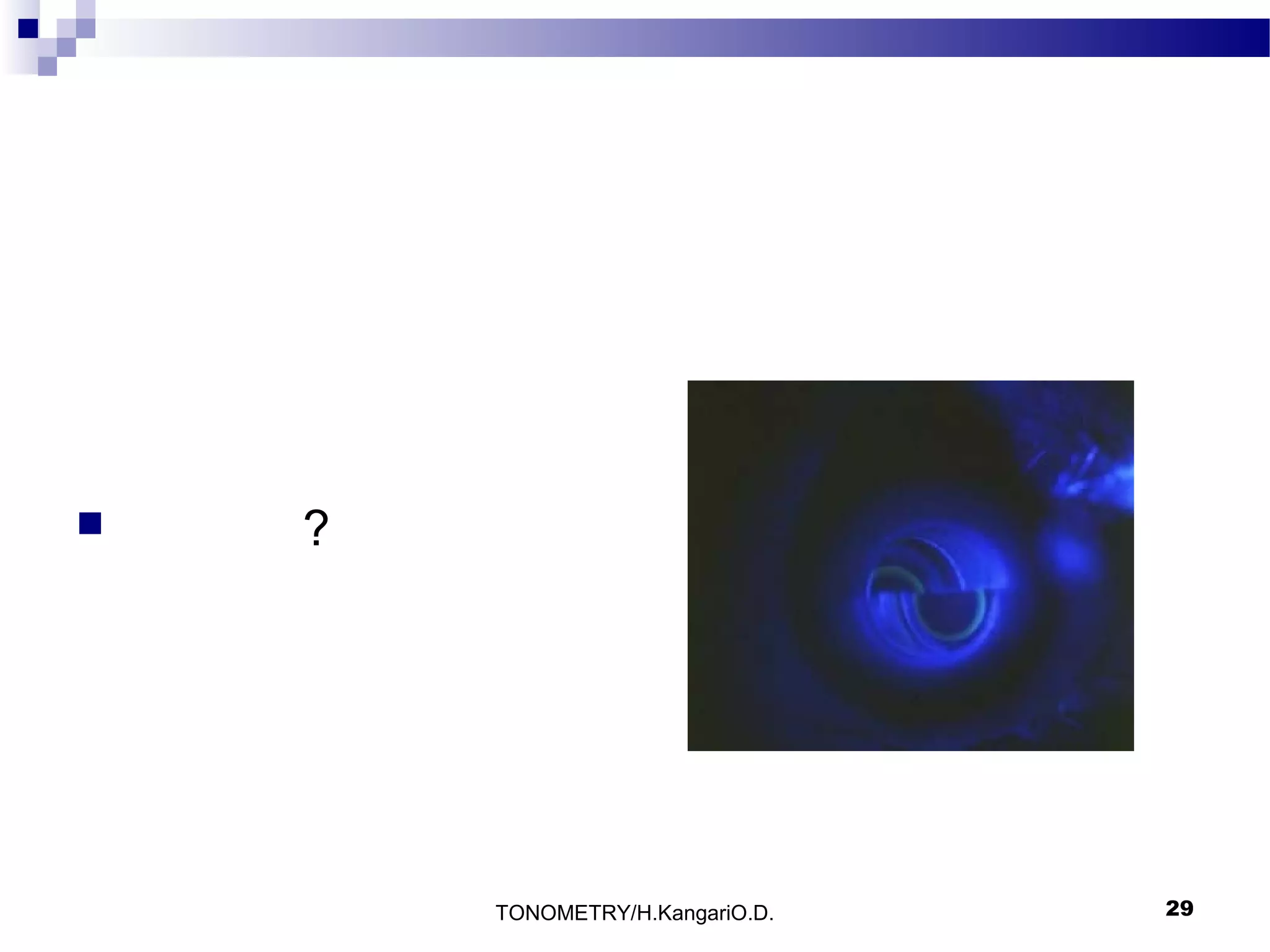 

?

TONOMETRY/H.KangariO.D.

29

 