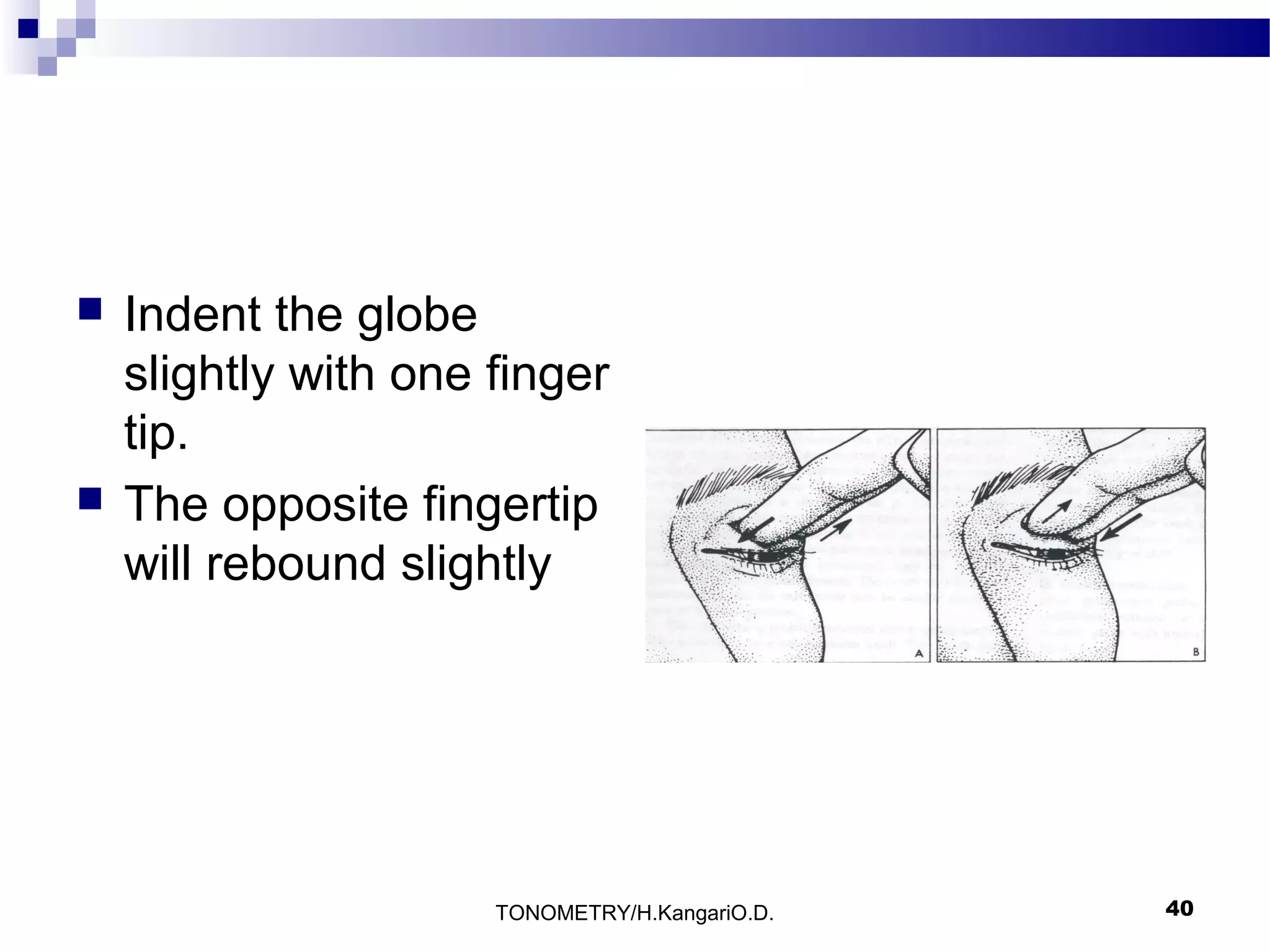 



Indent the globe
slightly with one finger
tip.
The opposite fingertip
will rebound slightly

TONOMETRY/H.KangariO.D.

40

 