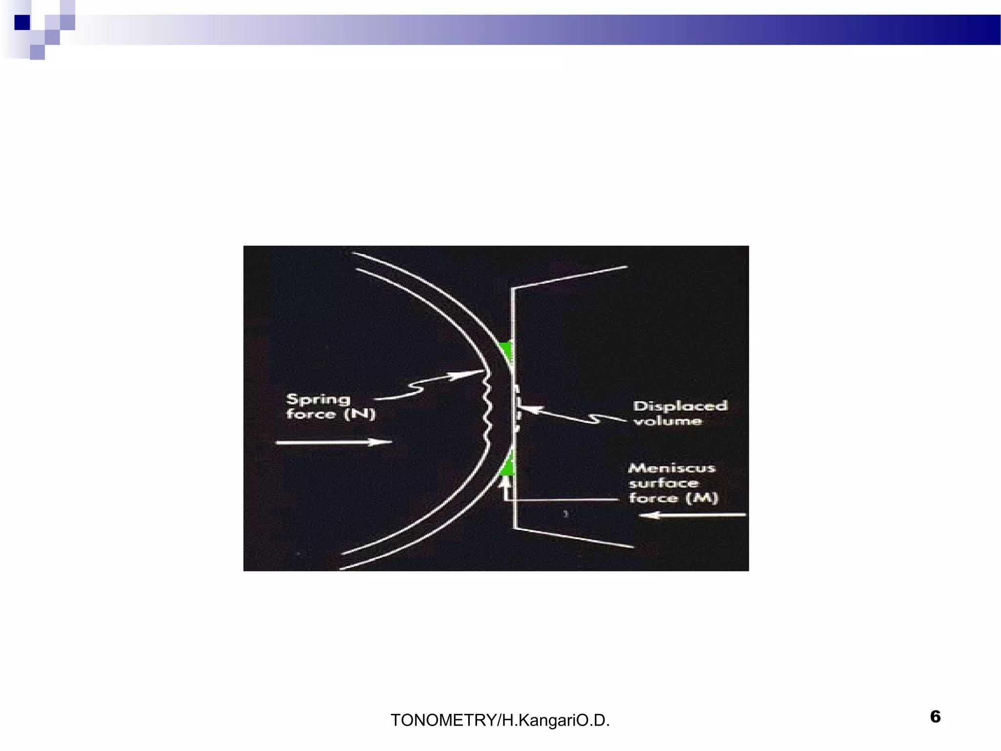 TONOMETRY/H.KangariO.D.

6

 