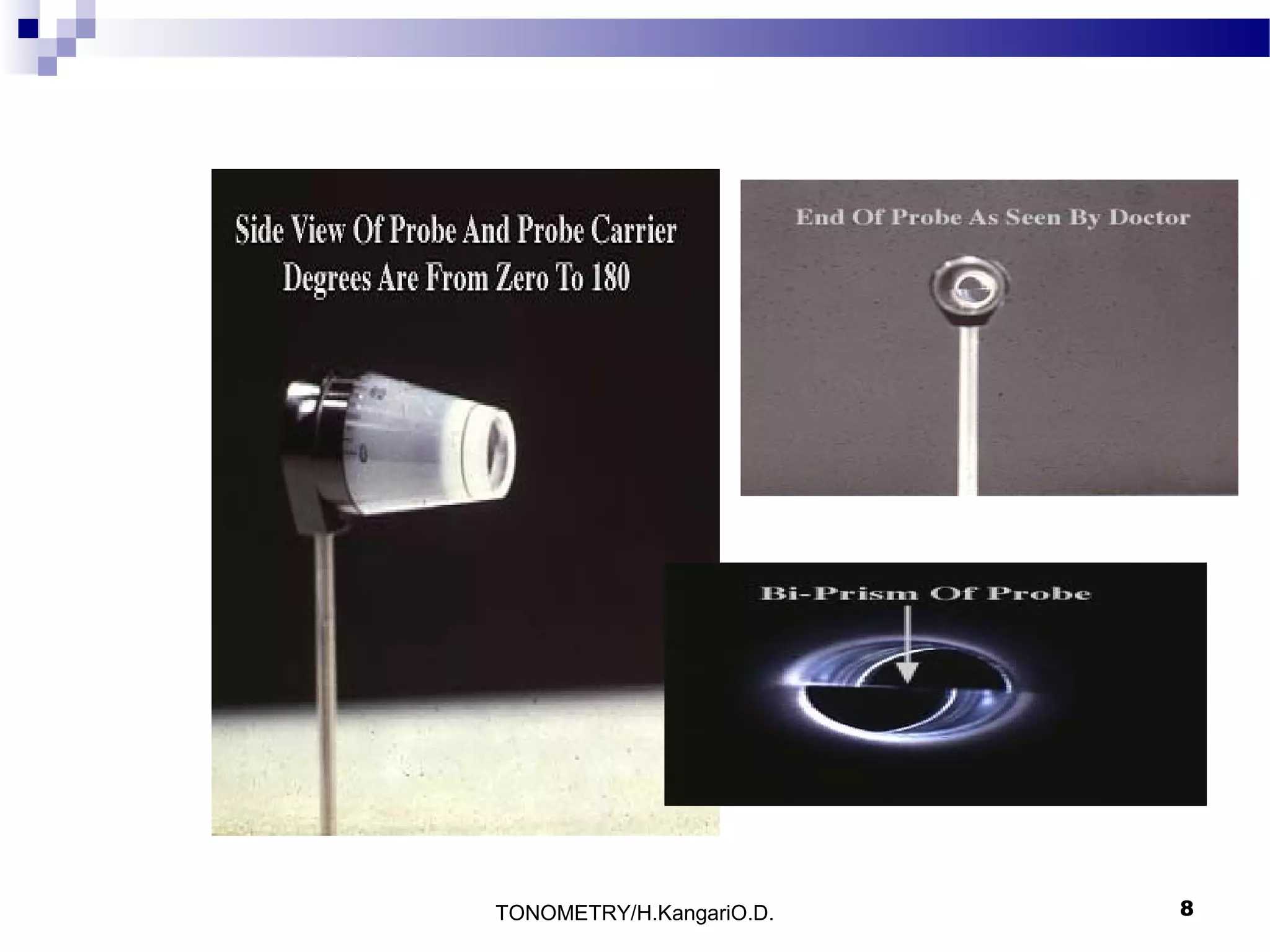 TONOMETRY/H.KangariO.D.

8

 