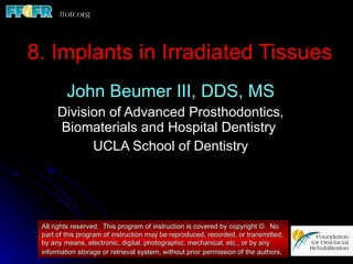 8. Implants in Irradiated Tissues John Beumer III, DDS, MS Division of Advanced Prosthodontics, Biomaterials and Hospital Dentistry  UCLA School of Dentistry All rights reserved.  This program of instruction is covered by copyright ©.  No part of this program of instruction may be reproduced, recorded, or transmitted, by any means, electronic, digital, photographic, mechanical, etc., or by any information storage or retrieval system, without prior permission of the authors . 