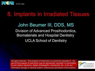 8. Implants in Irradiated Tissues
         John Beumer III, DDS, MS
      Division of Advanced Prosthodontics,
      Biomaterials and Hospital Dentistry
            UCLA School of Dentistry




 All rights reserved. This program of instruction is covered by copyright ©. No
 part of this program of instruction may be reproduced, recorded, or transmitted,
 by any means, electronic, digital, photographic, mechanical, etc., or by any
 information storage or retrieval system, without prior permission of the authors.
 