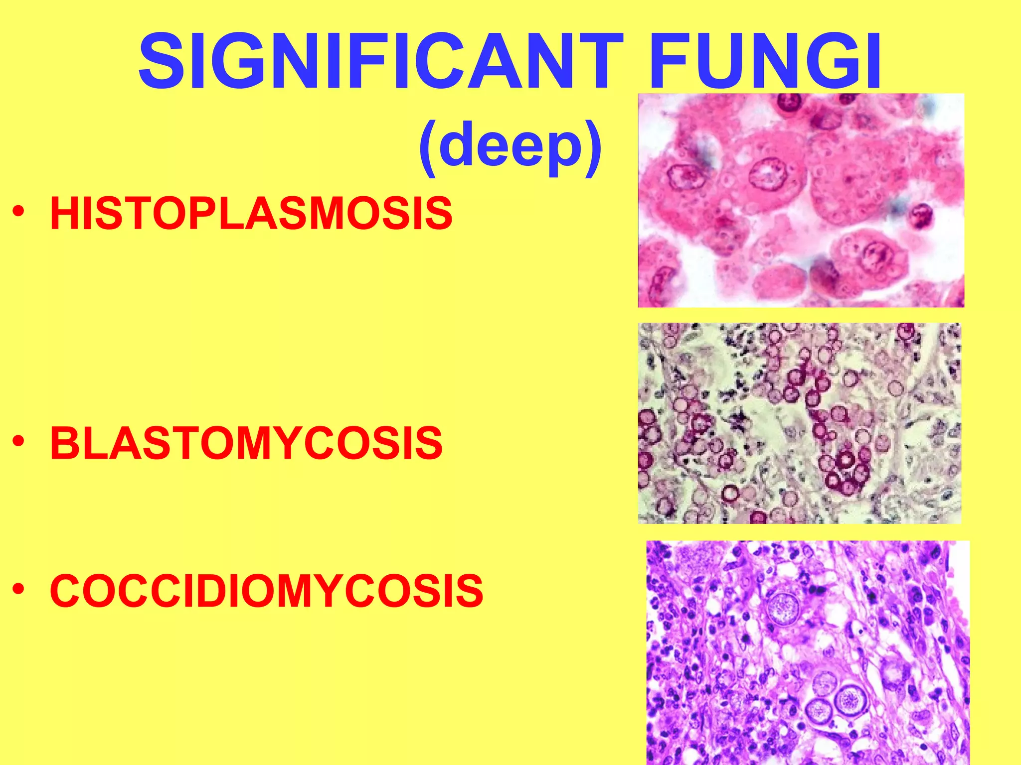 SIGNIFICANT FUNGI 
(deep) 
• HISTOPLASMOSIS 
• BLASTOMYCOSIS 
• COCCIDIOMYCOSIS 
 