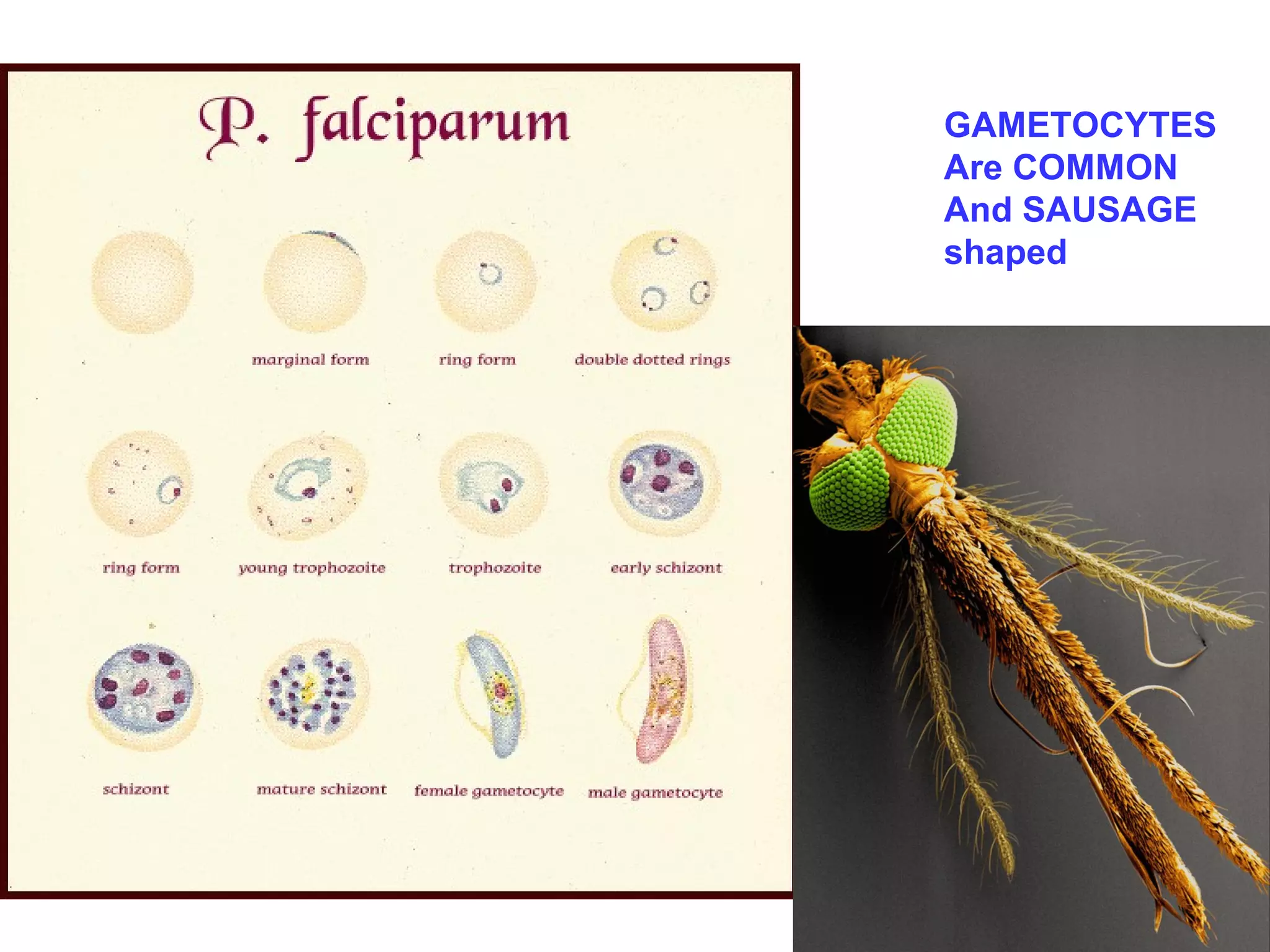 GAMETOCYTES 
Are COMMON 
And SAUSAGE 
shaped 
 