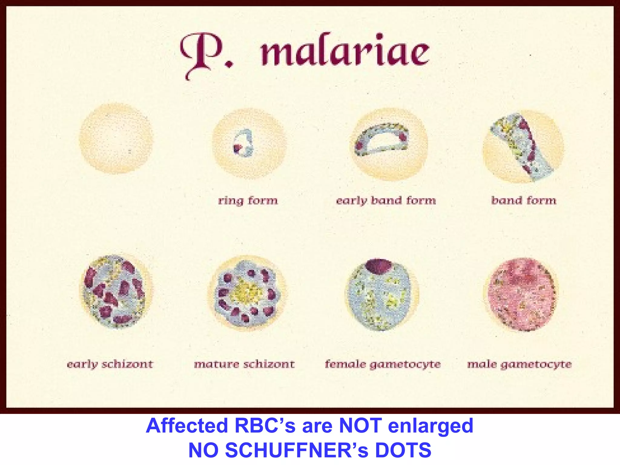 Affected RBC’s are NOT enlarged 
NO SCHUFFNER’s DOTS 
 