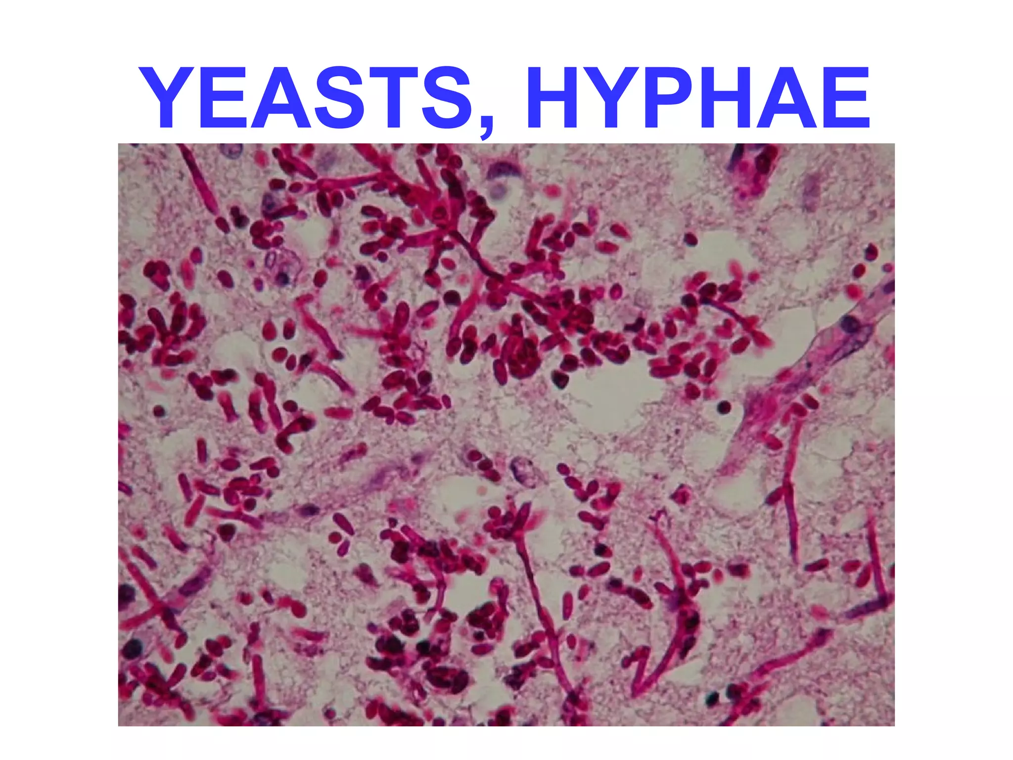 YEASTS, HYPHAE 
 