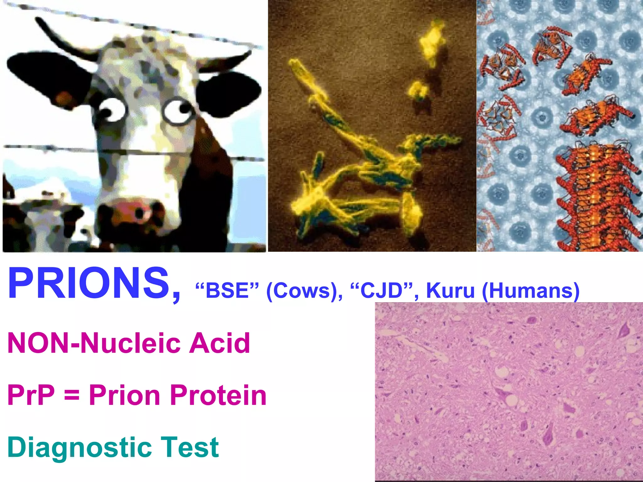PRIONS, “BSE” (Cows), “CJD”, Kuru (Humans) 
NON-Nucleic Acid 
PrP = Prion Protein 
Diagnostic Test 
 